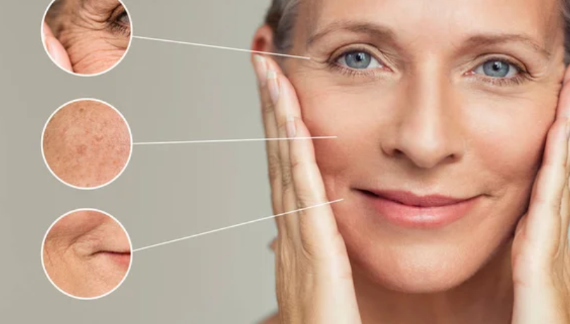 Anti Aging Treatment