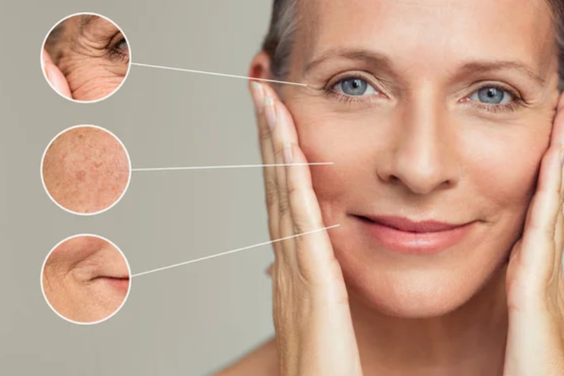 Anti Aging Treatment