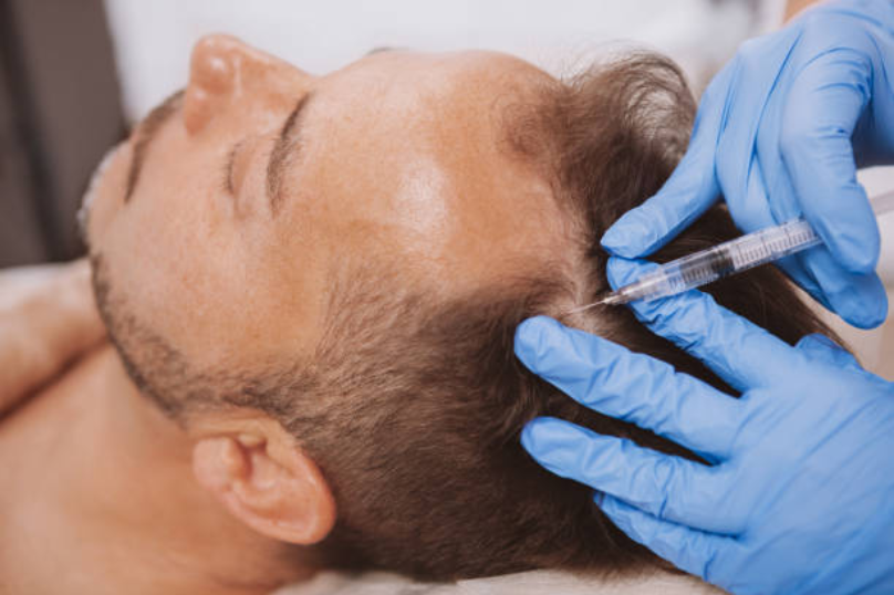 PRP Treatment In Punjabi Bagh