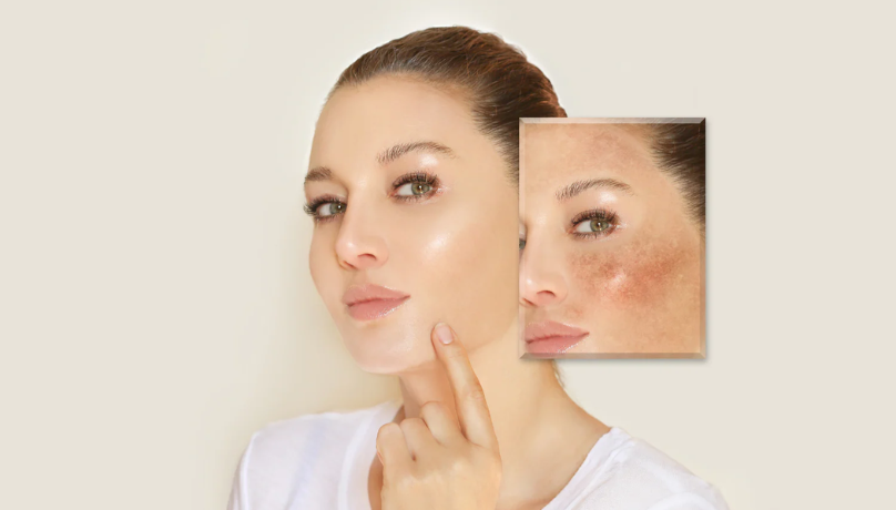 Untitled (808 x 538 px) (2)